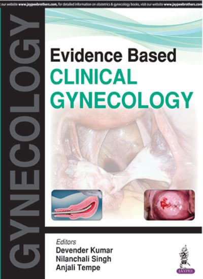 Evidence Based Clinical Gynecology 1st/2017