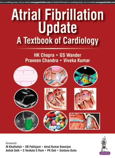 Atrial Fibrillation Update 1st/2017