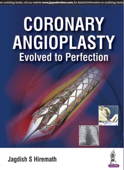 Coronary Angioplasty 1st/2017