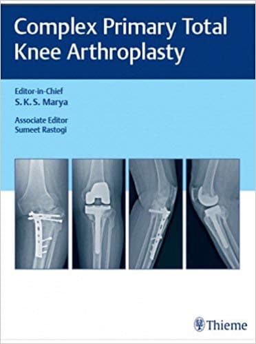 Complex Primary Total Knee Arthroplasty 1st/2017