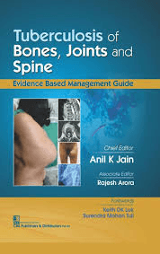 Tuberculosis Of Bones, Joints and Spine 1st/2017