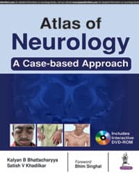 Atlas of Neurology 1st/2017