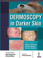 Dermoscopy in Darker Skin 1st/2017