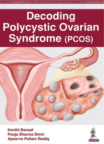 Decoding Polycystoc Ovarian Syndrome (PCOS) 1st/2017