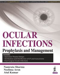 Ocular Infections Prophylaxis and Management 1st/2017