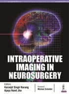 Intraoperative Imaging in Neurosurgery 1st/2017