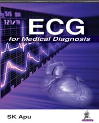 ECG for Medical Diagnosis 1st/2017