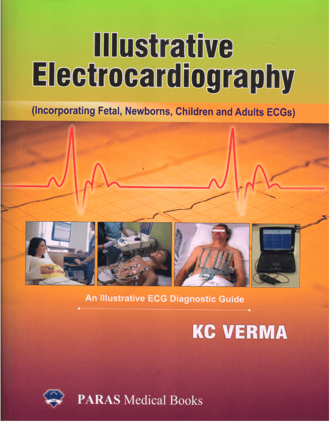 Illustrative Electrocardiography 1st/2020