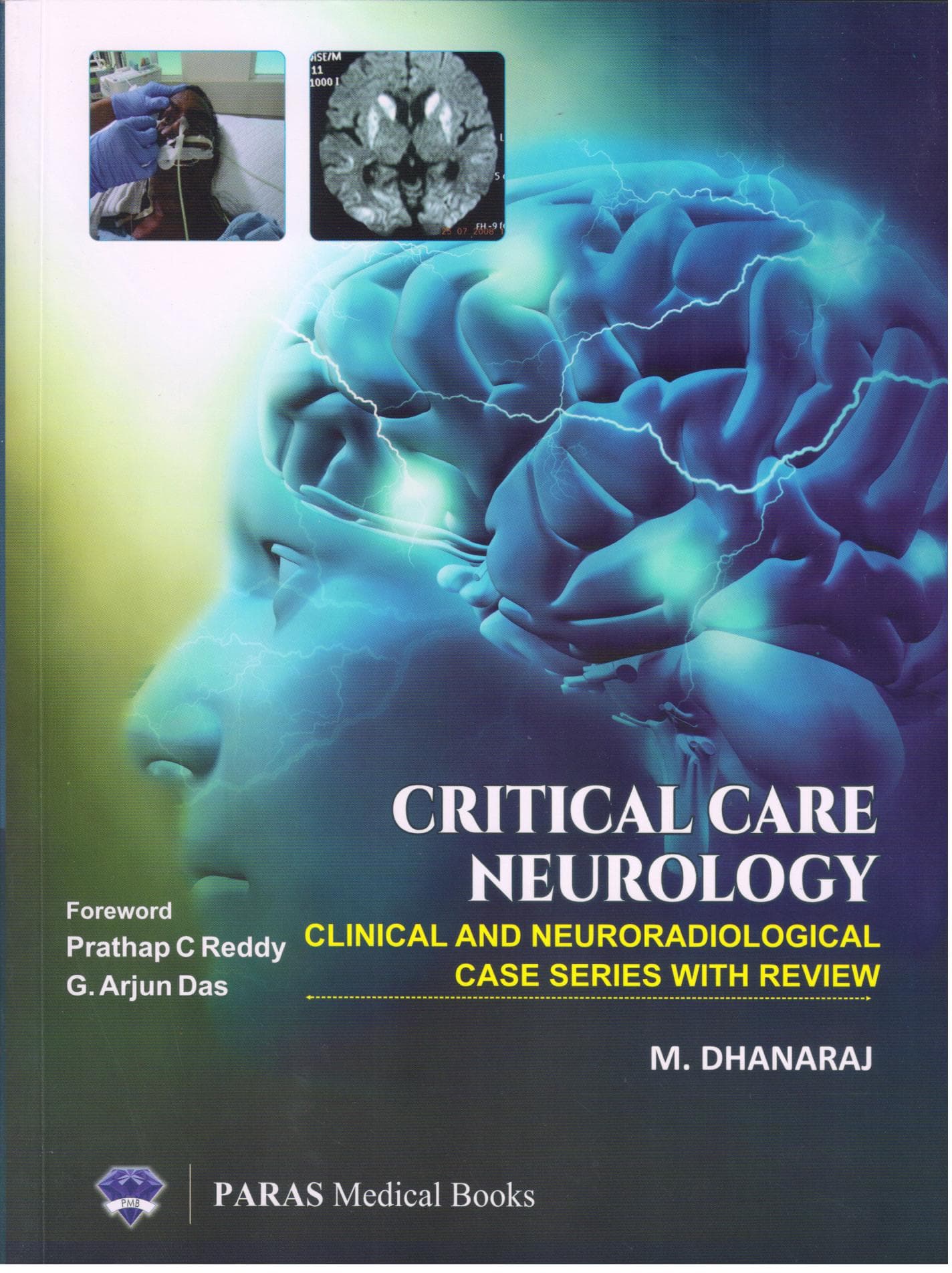 Critical Care Neurology 1st/2019