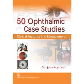 50 Ophthalmic Case Studies 1st/2017