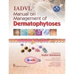 IADVL Manual on Management of Dermatophytoses 1st/2018