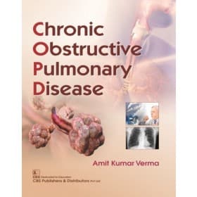 Chronic Obstructive Pulmonary Disease 1st/2019