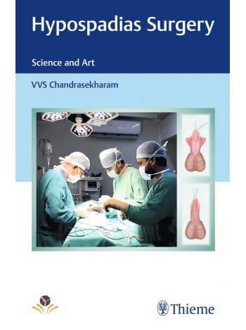 Hypospadias Surgery Art and Science 1st/2020