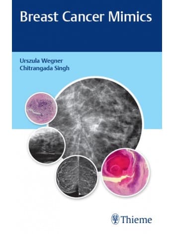 Breast Cancer Mimics 1st/2020