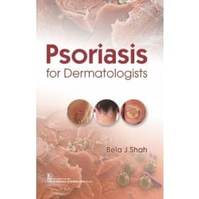 Psoriasis for Dermatologists 1st/2020
