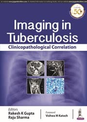 Imaging in Tuberculosis 1st/2019