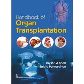 Handbook of Organ Transplantation 1st/2020