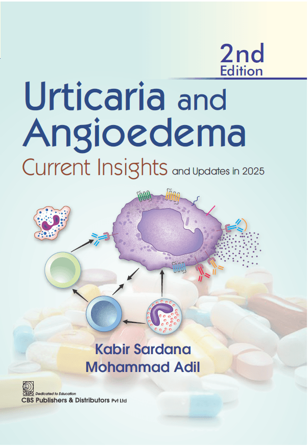 Urticaria and Angioedema 2nd/2026