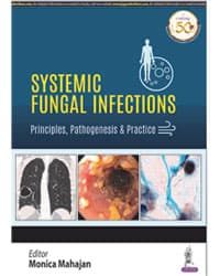 Systemic Fungal Infections 1st/2020
