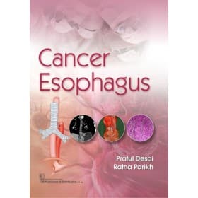 Cancer Esophagus 1st/2020