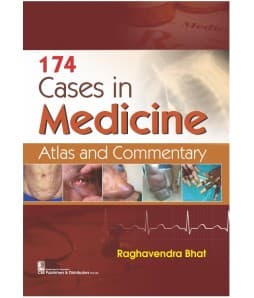 174 Cases in Medicine 1st/2021