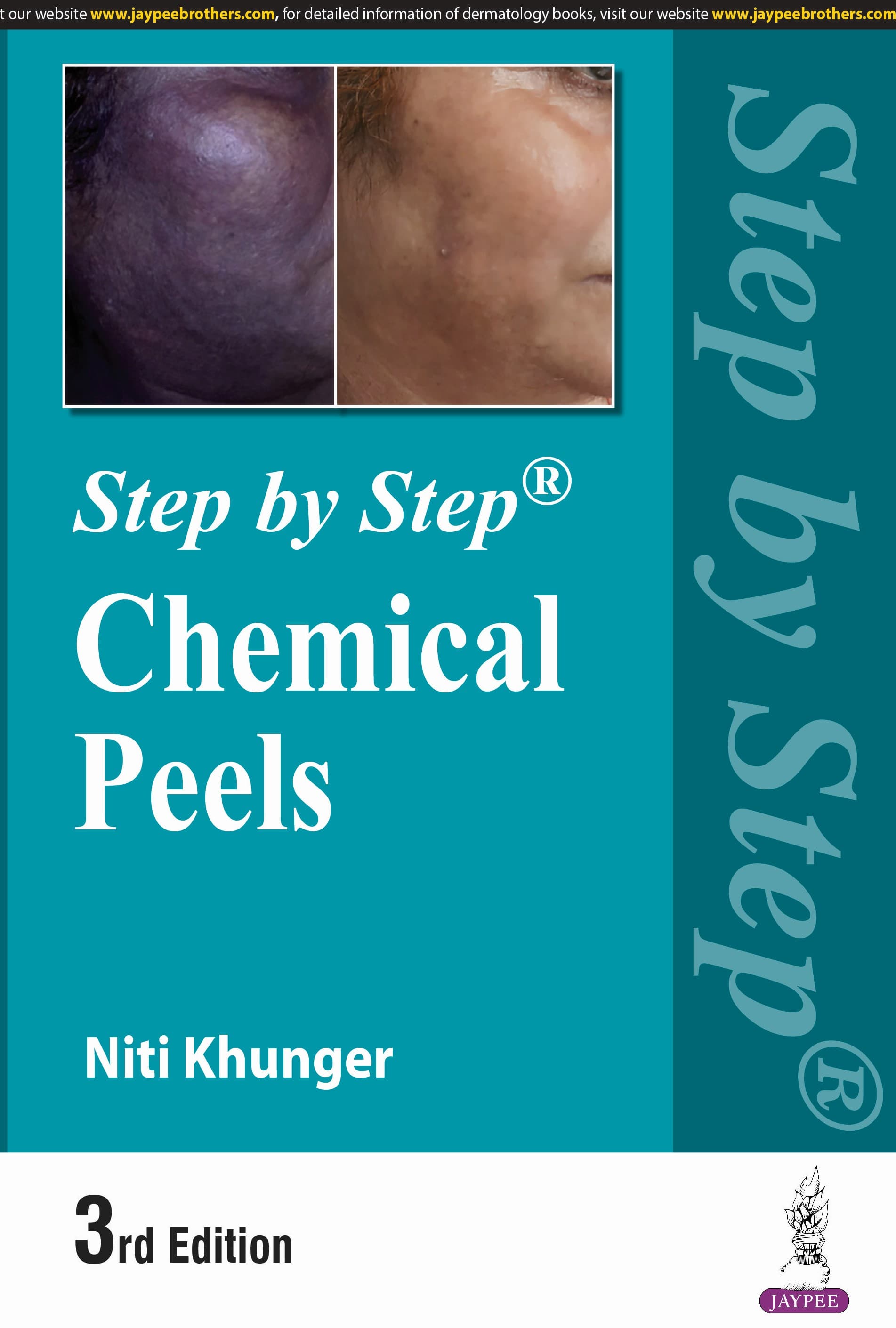 Step by Step Chemicals Peels 3rd/2024