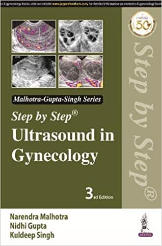 Step by Step Ultrasound in Gynecology 3rd/2021