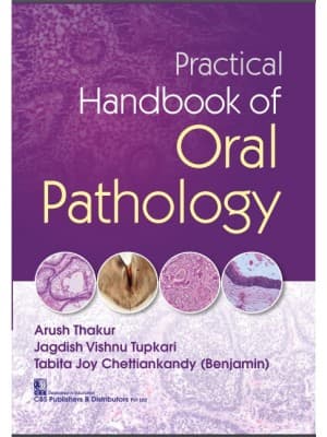 Practical Handbook of Oral Pathology 1st/2021