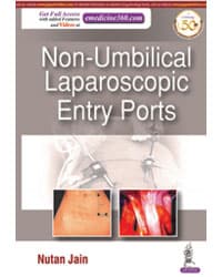 Non Umbilical Laparoscopic Entry Ports 1st/2020