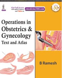 Operations in Obstetrics & Gynecology: Text And Atlas 1st/2020