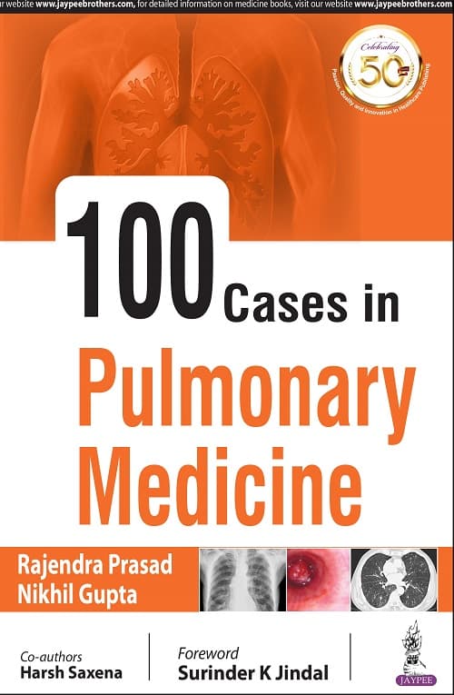 100 Cases in Pulmonary Medicine 1st/2020