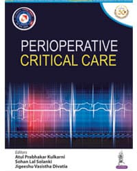 Perioperative Critical Care 1st/2021