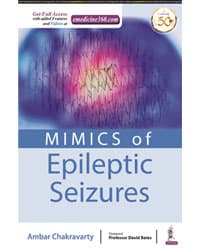 Mimics of Epileptic Seizures 1st/2020