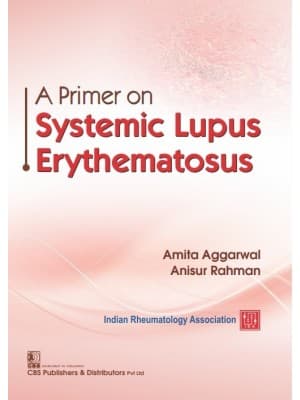 A Primer on Systemic Lupus Erythematosus 1st/2021