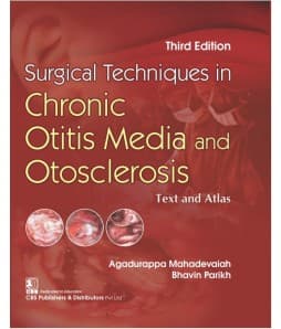 Surgical Techniques in Chronic Otitis Media and Otosclerosis 3rd/2021