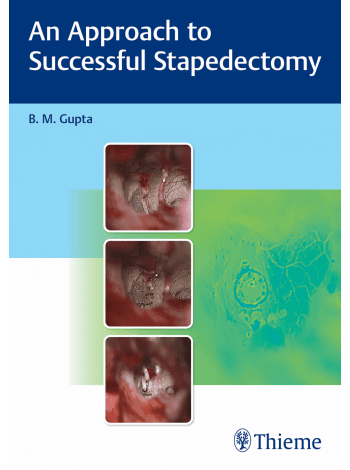 An Approach to Successful Stapedectomy 1st/2022