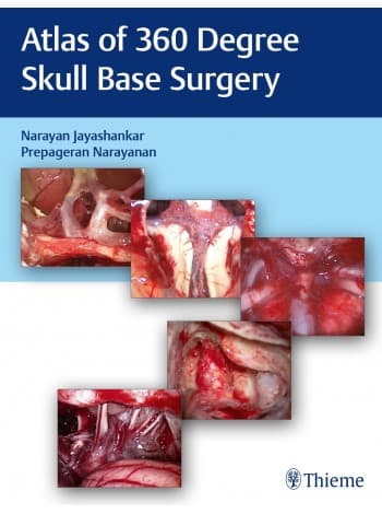 Atlas of 360 Degree Skull Base Surgery 1st/2021