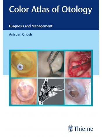 Color Atlas of Otology 1st/2021