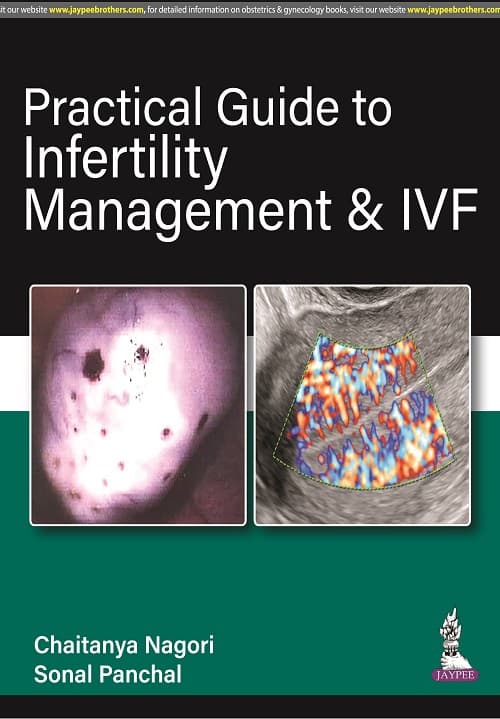 Practical Guide to Infertility Management & IVF 1st/2022