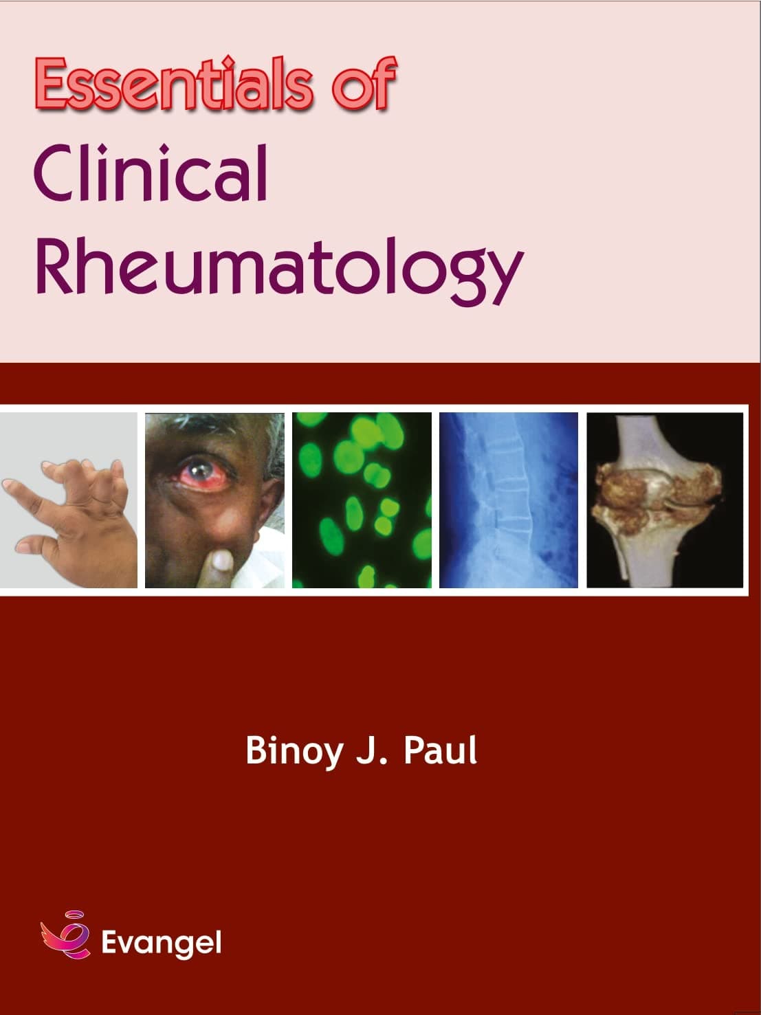 Essentials of Clinical Rheumatology 1st/2022