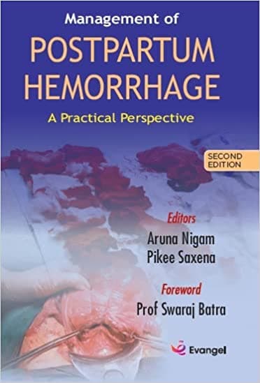 Management of Postpartum Hemorrhage 2nd/2022