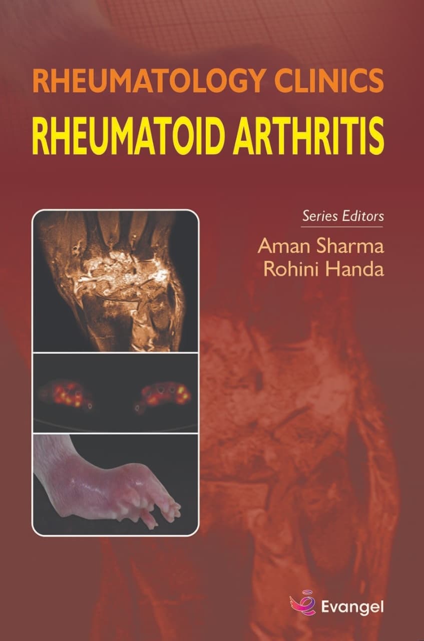 Rheumatology Clinics Rheumatoid Arthritis 1st/2022