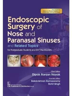Endoscopic Surgery Of Nose And Paranasal Sinuses And Related Topics 1st/2022