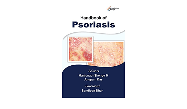 Handbook of Psoriasis 1st/2022