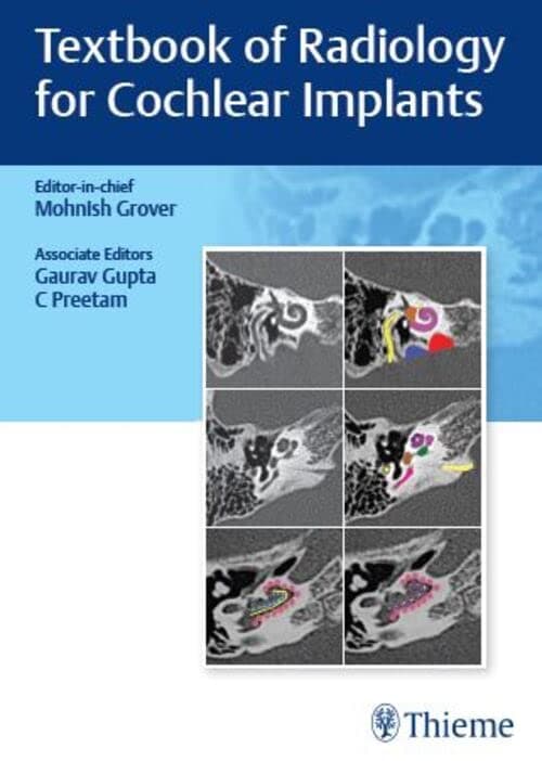 Textbook of Radiology for Cochlear Implants 1st/2022