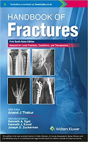 Handbook of Fractures 1st SAE/2022