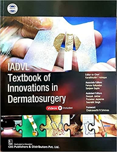 IADVL Textbook of Innovations In Dermatosurgery 1st/2022