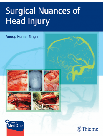 Surgical Nuances of Head Injury 1st/2022
