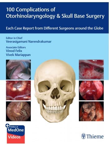 100 Complications of Otorhinolaryngology & Skull Base Surgery 1st/2023