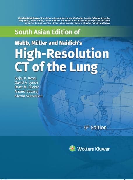 Webb, Muller and Naidich's High Resolution CT of the Lung 6th SAE/2022